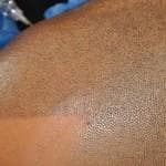 Scalp tattoo