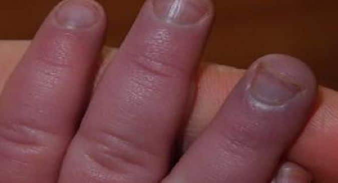 Terrys nails or normal? They have been white since i can remember. :  r/asknurses