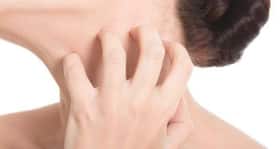 6 home remedies for itchy skin 6 home remedies for itchy skin