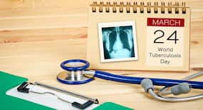 World TB Day 2017 -- 10 reasons doctors think the tuberculosis burden is rising