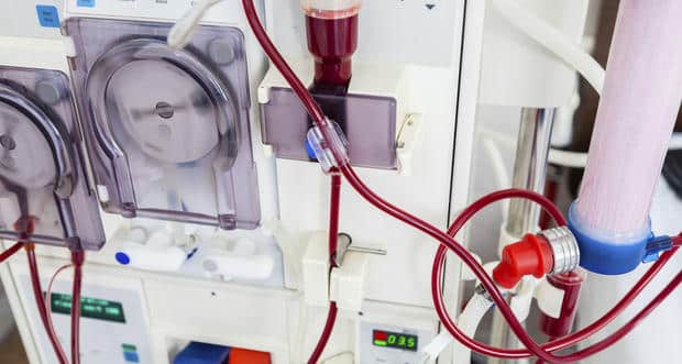 kidney dialysis