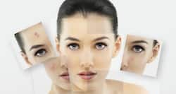 6 home remedies to get rid of dark skin patches