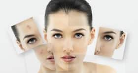 6 home remedies to get rid of dark skin patches
