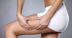 Women’s Day 2015: Tired of cellulite? Try these 5 simple tips to conquer it!