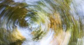 Vertigo--causes, symptoms, diagnosis and prevention