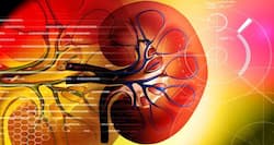 Summer tips: 5 things you should do to avoid kidney stones in this heat