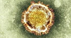 Scientists identify a new SARS-like virus in bats that could infect humans