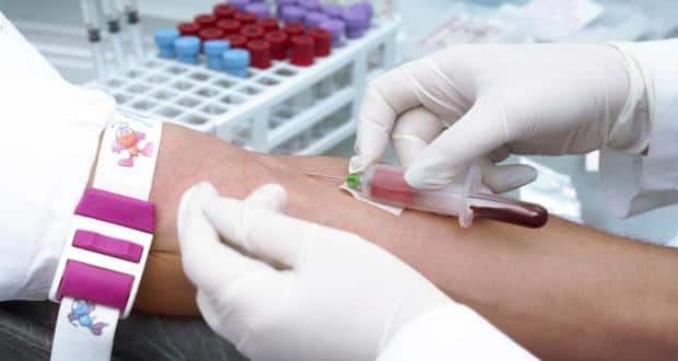 blood-test