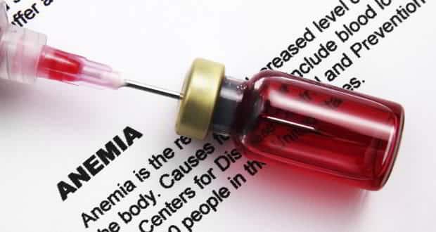 Anemia-symptoms