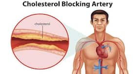 '3 in 1,000 undergo angioplasty in India'