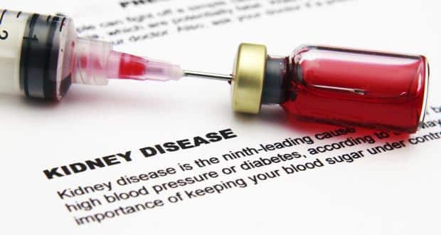Chronic kidney disease