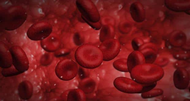 Anemia