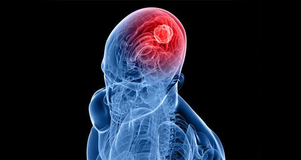 cancer-brain