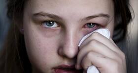 Try these fool-proof remedies for pink eye