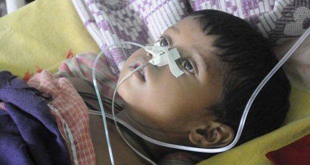 encephalitis