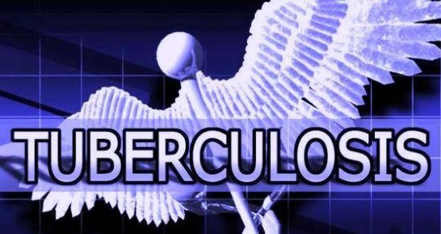 tuberculosis