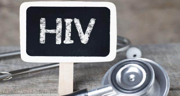 HIV infection
