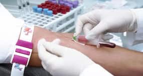 Take this  blood test and find out what you will die from!
