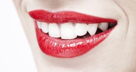 Simple kitchen ingredients that can make your teeth white