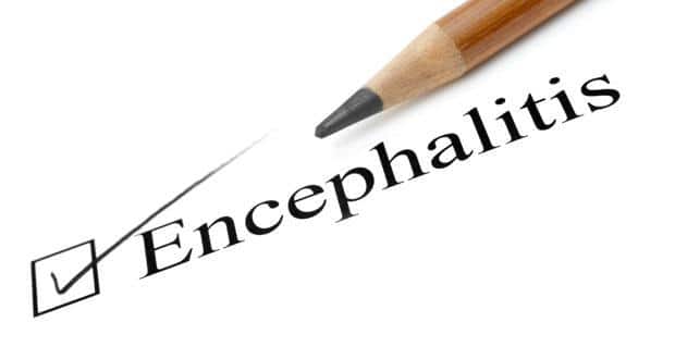 encephalitis