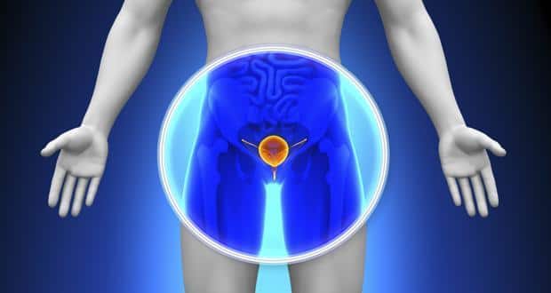 Symptoms of enlarged prostate 