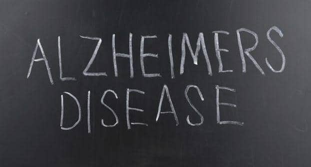 alzheimers