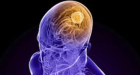 Olive oil nutrient may help prevent brain cancer