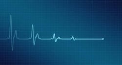 ECGs to be now available in remote areas, thanks to IIT-Hyderabad