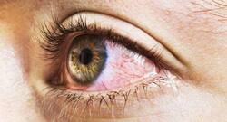 Can wearing dark glasses prevent conjunctivitis from spreading?