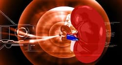 Post-surgery care for kidney transplant patients a must for better recovery