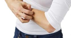 Beauty Tip #38 -- Soothe skin rashes with cucumber or aloe vera gel