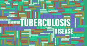 MDR-TB cases on the rise--all you should know about the deadly disease