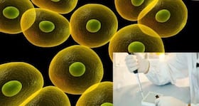 8 Surprising Diseases Stem Cells Can Cure 8 Surprising Diseases Stem Cells Can Cure