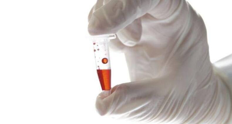 7 tips to prevent the spread of Ebola