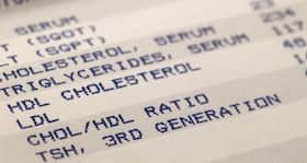 Experts say you need not fast before a cholesterol exam