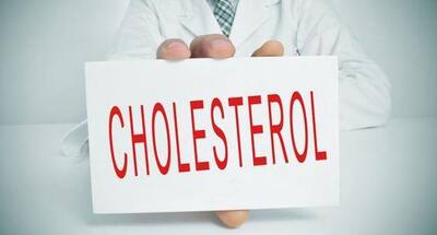 Now, a map to tell you how cholesterol is made | TheHealthSite.com