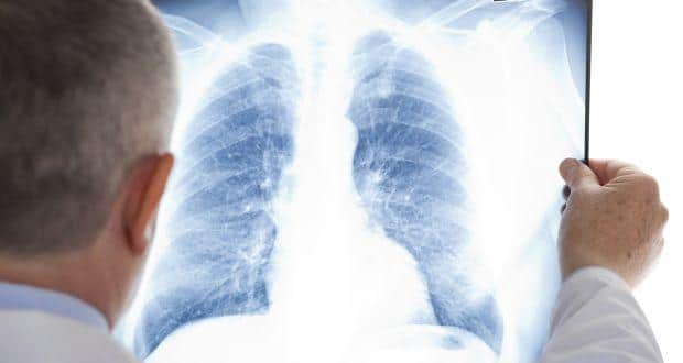 Lungs