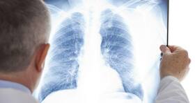 Now, ibuprofen could help you breathe easy Now, ibuprofen could help you breathe easy