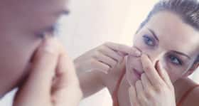 Blackheads and whiteheads – how to get rid of them
