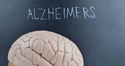 Keep Alzheimer's at bay with these tips