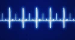 Heartbeats can now be measured without placing sensors on the body