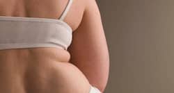 170 kg morbidly obese woman fights all odds to give birth to health baby