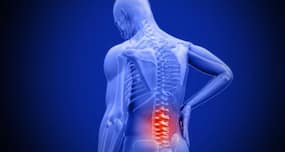 A 55-year-old man treated for lumbar spinal stenosis with minimal invasive surgery