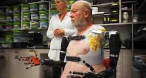 World's first working prosthetic limbs developed