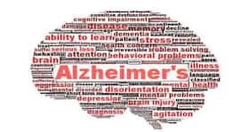Bad lifestyle responsible for 76 percent of brain ageing: Research Bad lifestyle responsible for 76 percent of brain ageing: Research