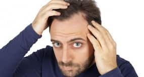 Can stress cause hair loss? (Beauty query of the day)