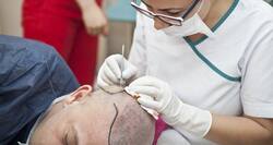 5 surgical treatment options for hair loss