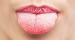 Now, a new 'tongue test system' to diagnose 14 different illnesses