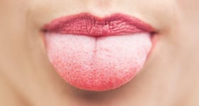3D tongue images help patients improve their speech