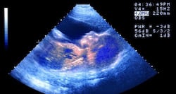 Can I get pregnant with my own eggs after menopause? + other questions on IVF answered